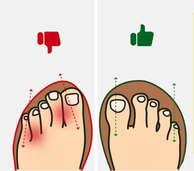 Wide toe box comparison of the Grounded barefoot shoe