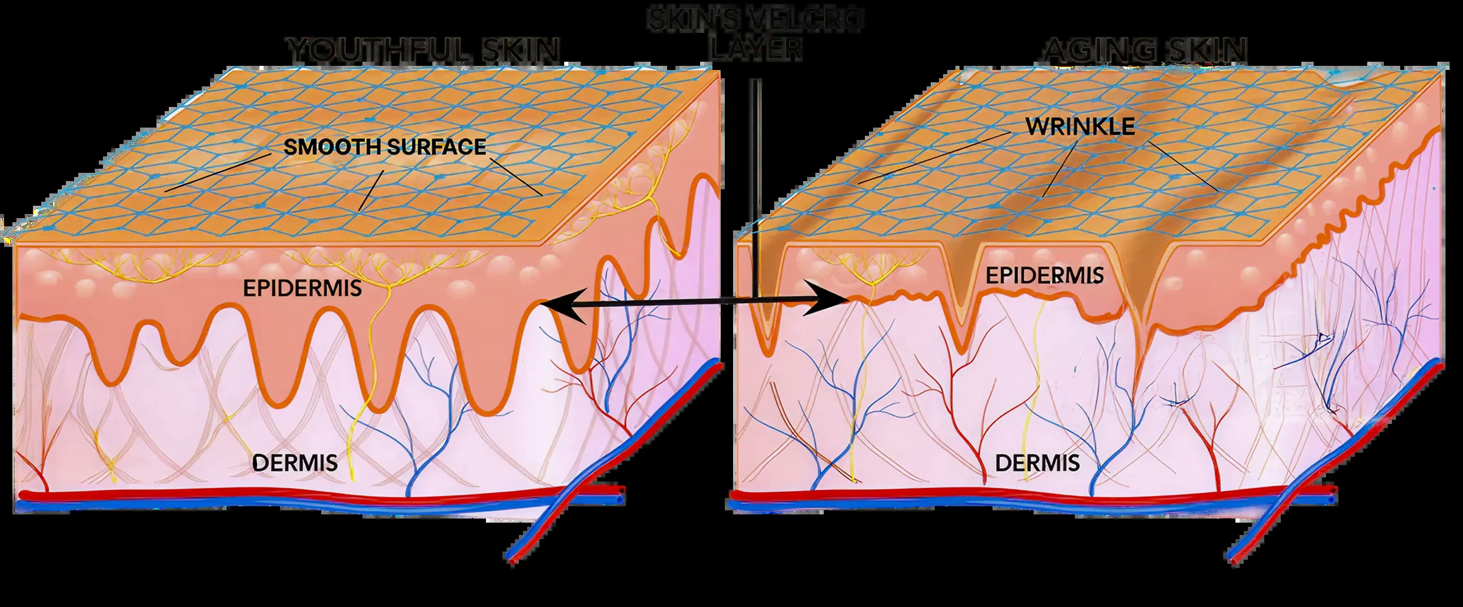 Skin's velcro layer - youthful skin vs aging skin cross-section