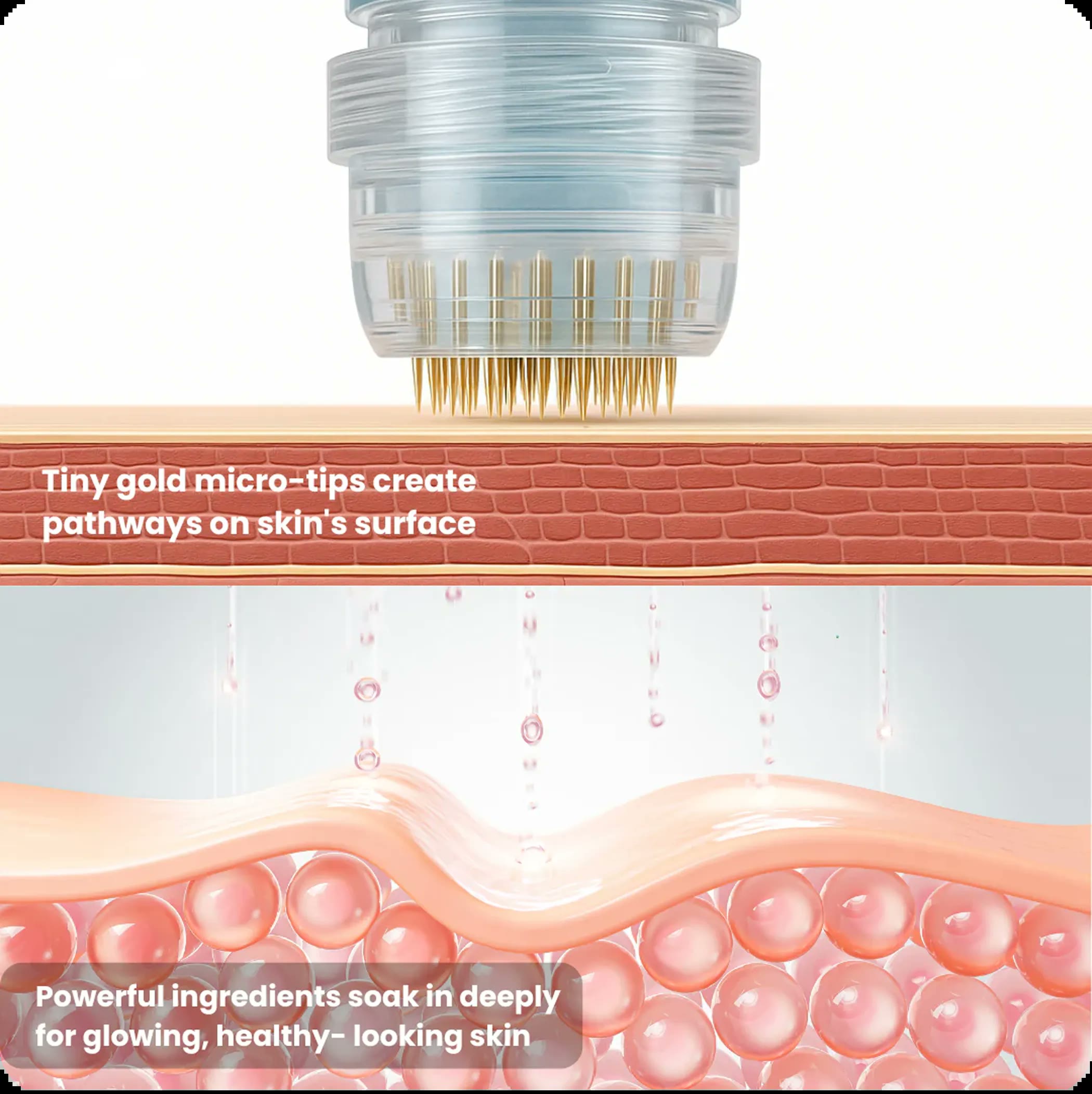 Renewa Micro Infusion System device in use